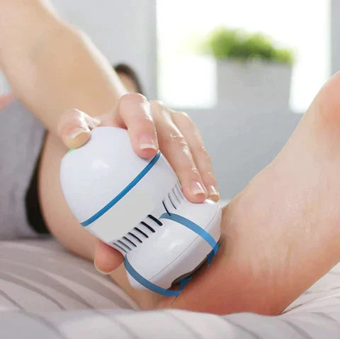 Lunora Vacuum Callus Remover